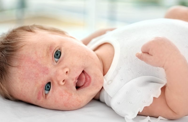 How do I know if my baby is allergic?